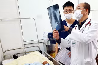 Bệnh nhân được điều trị tại Bệnh viện Bạch Mai.