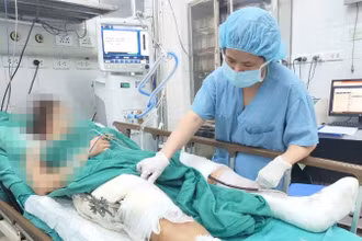 Bệnh nhân Nguyễn Thị N. (32 tuổi; Gia Lộc, Hải Dương) chẩn đoán đa chấn thương, đang được chăm sóc tại khoa Hồi tỉnh 3, Trung tâm Gây mê và Hồi sức Ngoại khoa. 