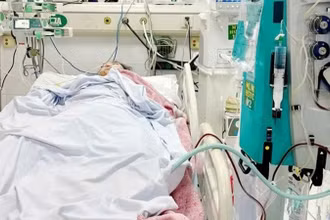 Cứu sống nữ sinh trẻ bị sốc nhiễm khuẩn nặng do liên cầu khuẩn nhóm A