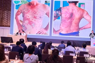 Các chuyên gia trình bày một ca bệnh lý về da với các đại biểu dự hội nghị