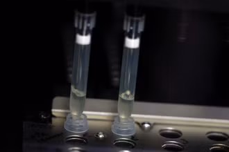 Hai mẫu bệnh phẩm nghi ngờ nhiễm virus đậu mùa khỉ đang trong quá trình xét nghiệm tại phòng thí nghiệm vi sinh, Bệnh viện La Paz, Madrid, Tây Ban Nha, ngày 1/6/2022. (Ảnh: Reuters)