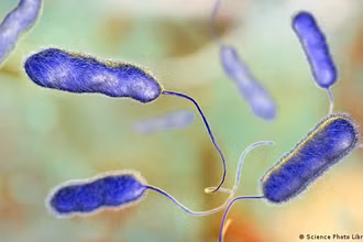 Vi khuẩn Legionella gây ra các triệu chứng như cúm đến nhiễm trùng phổi nặng và viêm phổi ở người. (Ảnh: IMAGO) 