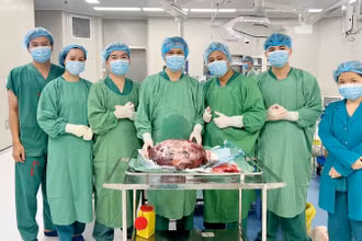 Các y, bác sĩ Bệnh viện Ung bướu tỉnh Kiên Giang phẫu thuật thành công lấy khối u ra khỏi cơ thể bệnh nhân. (Ảnh: BS MƯỜI).