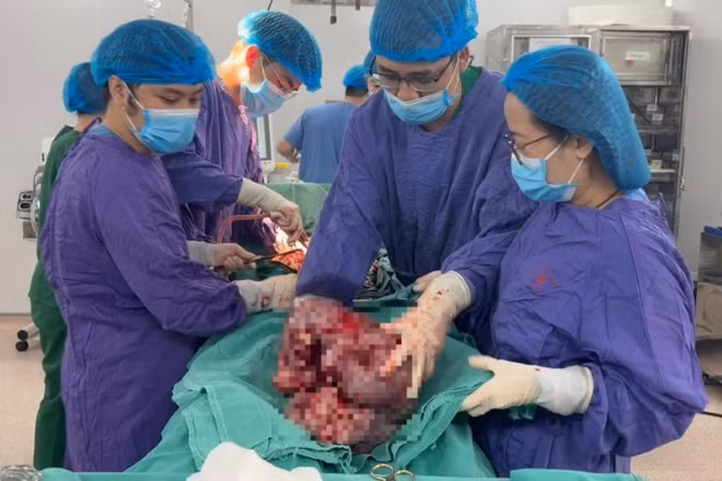 Kíp phẫu thuật xử lý bóc tách khối u.