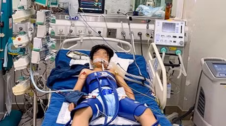 M. ngừng tuần hoàn gần 1 giờ đồng hồ.