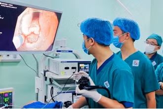 Ông C được can thiệp bằng nội soi ESD tại Bệnh viện Trung ương Thái Nguyên để điều trị ung thư thực quản.