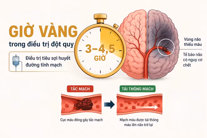  "Giờ vàng" đột quỵ: Ranh giới của hồi phục và tàn phế
