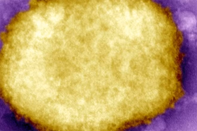 Một loại virus đậu mùa khỉ. (Ảnh: Thời báo Hà Lan)