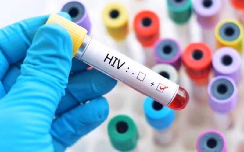 Sửa quy định về cấp giấy chứng nhận bị phơi nhiễm với HIV, bị nhiễm HIV do tai nạn rủi ro nghề nghiệp. (Ảnh minh họa)