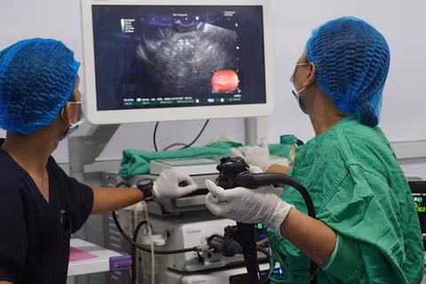 Ê-kíp của Bệnh viện đa khoa Trung ương Cần Thơ nội soi đặt stent LAMS cho bệnh nhân. (Ảnh minh họa: nhandan.vn)