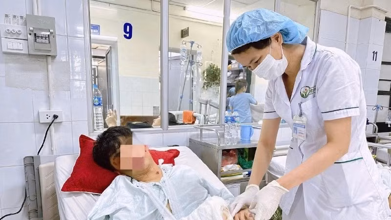 Điều trị tai nạn pháo nổ tại Bệnh viện Việt Đức. (Ảnh: Bệnh viện Việt Đức)