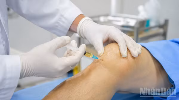 Cẩn trọng trong việc sử dụng tế bào gốc điều trị khớp gối