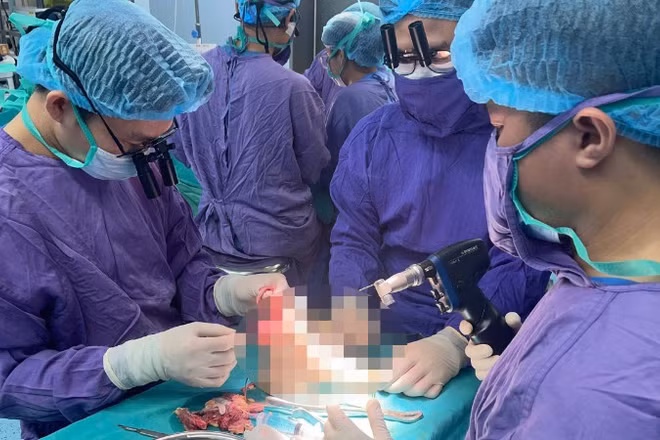 Kíp y, bác sĩ thực hiện ca phẫu thuật xuyên đêm cứu bàn chân cho nữ sinh gặp nạn.