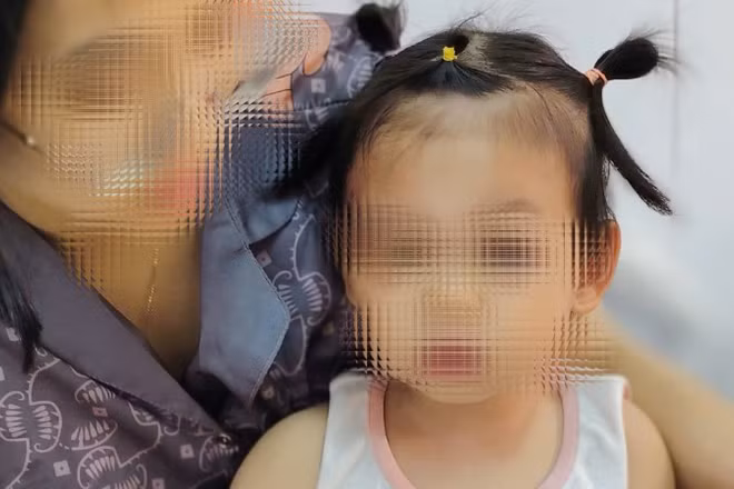 Bệnh nhi được cấp cứu kịp thời.