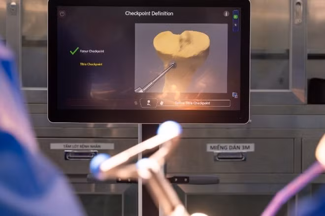 Robot CORI tích hợp trí tuệ nhân tạo AI đóng vai trò như “trợ lý” thông minh giúp bác sĩ thực hiện ca mổ đạt độ chính xác cao.