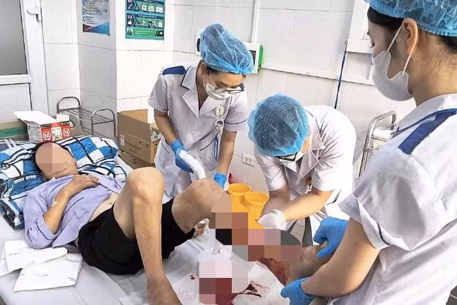Thời gian gần đây, Bệnh viện Bệnh Nhiệt đới Trung ương liên tục tiếp nhận các ca viêm mô bào hoại tử chi trong tình trạng nguy kịch.