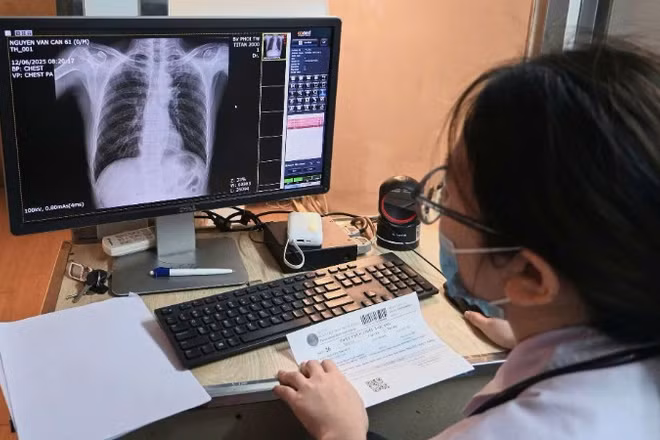 Chụp X-quang phổi sàng lọc bệnh lao. 