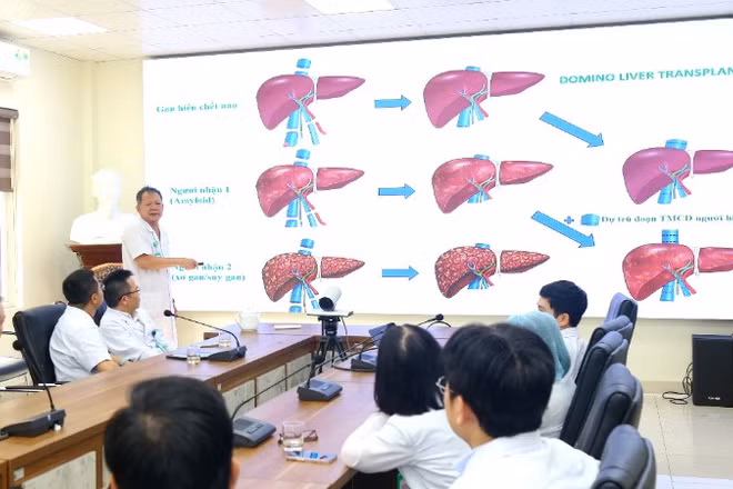Phó Giáo sư, Tiến sĩ Dương Đức Hùng, Giám đốc Bệnh viện Hữu nghị Việt Đức cùng các bác sĩ hội chẩn trường hợp ghép tạng domino đặc biệt. 