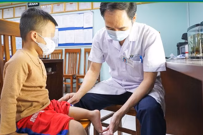 Tiến sĩ, bác sĩ Hoàng Hải Đức – Trưởng Khoa Chỉnh hình, Bệnh viện Nhi Trung ương, thăm khám cho bệnh nhi sau ca phẫu thuật xoay cẳng chân 180 độ.