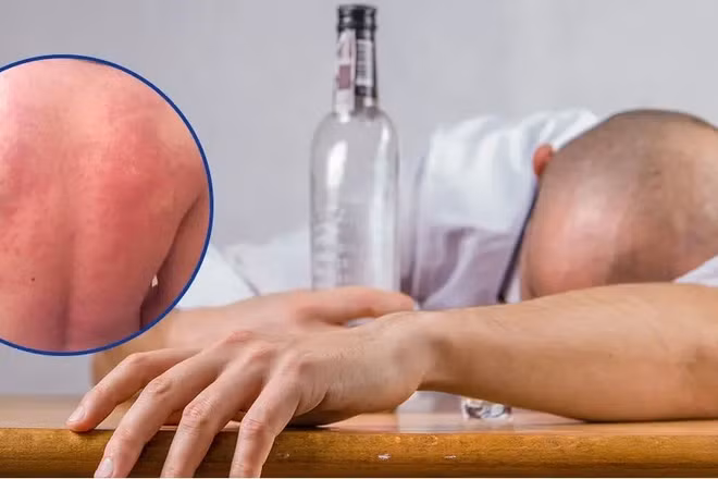 Ảnh minh họa.