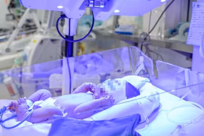Trẻ mang kháng thể anti-Jk3 - nhóm máu cực hiếm và ngân hàng máu cũng không có sẵn đơn vị tương thích để truyền.