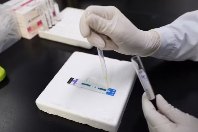 Bác sĩ xét nghiệm mẫu bệnh phẩm để phát hiện HIV/AIDS tại Bệnh viện Nhân dân số 4 Nam Ninh, thành phố Nam Ninh, Khu tự trị dân tộc Choang Quảng Tây, Trung Quốc, ngày 21/11/2024. (Ảnh: Tân Hoa Xã)