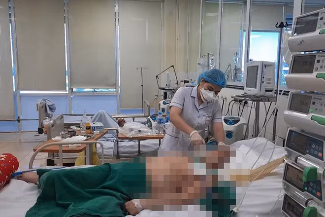 Bệnh nhân Covid-19 nặng đang điều trị tại Bệnh viện Bệnh Nhiệt đới Trung ương. (Ảnh: TĐ)