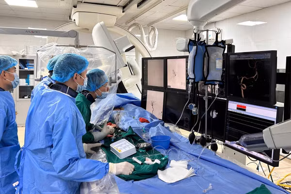 Các bác sĩ Bệnh viện Thanh Nhàn ứng dụng thiết bị y tế hiện đại điều trị thành công cho người bệnh có túi phình động mạch cảnh trong não (Ảnh: Vân Anh)