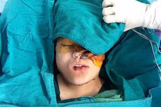 Phẫu thuật tái tạo lại gương mặt cho bệnh nhân.
