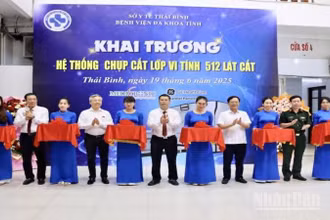 Các đại biểu thực hiện nghi thức cắt băng khai trương hệ thống chụp cắt lớp vi tính 512 lát cắt.